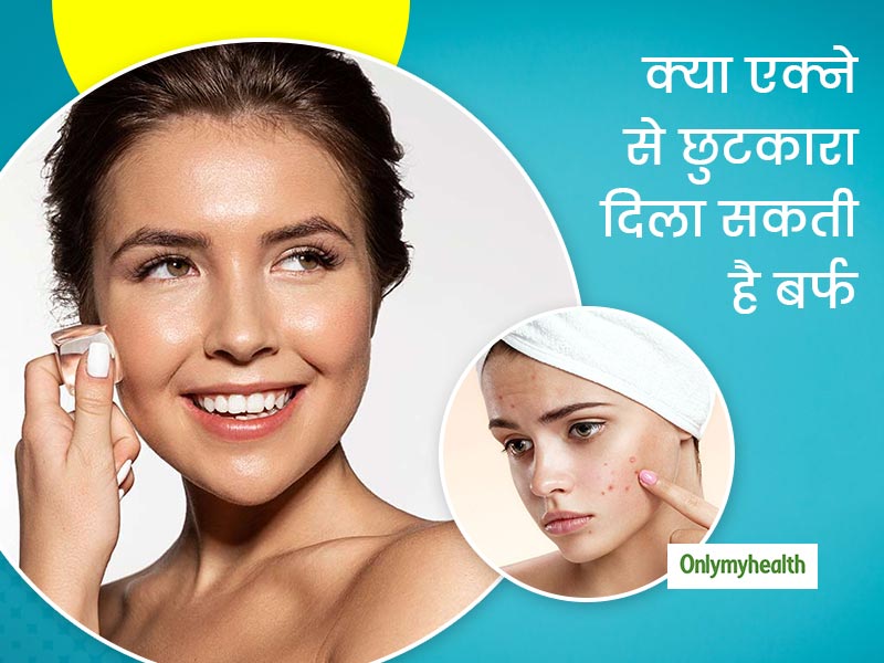 क्या सचमुच पिंपल्स से निपटने में मददगार है बर्फ? जानें कैसे एक्ने में प्रभावी हो सकता है बर्फ का उपयोग